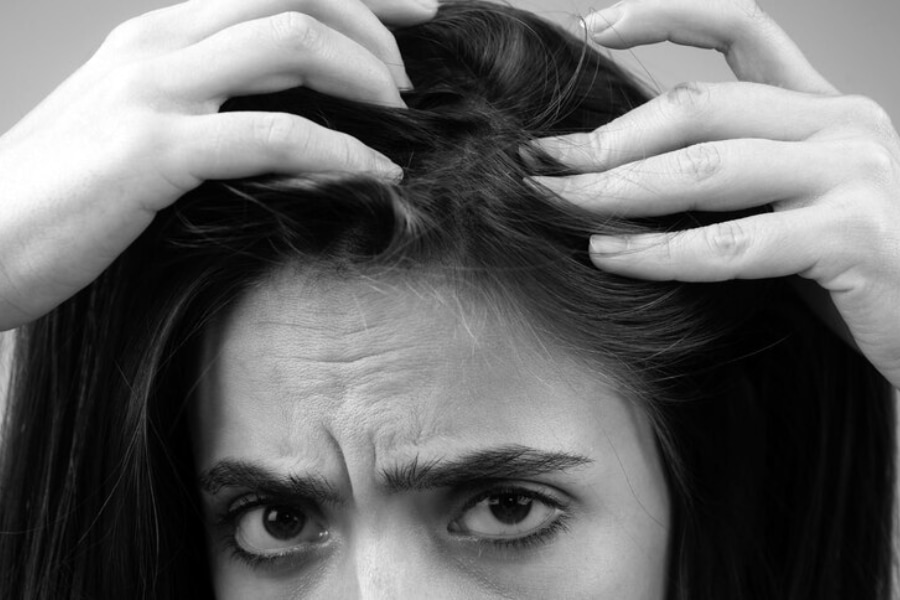 تعبیر خواب ریزش مو سکه ای، نشونه ای از تغییرات یا نگرانی هاست. شاید وقتشه یه تغییر مثبت توی زندگی شروع کنی!