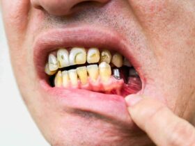 درد و ناراحتی ایمپلنت دندانی حتی پس از گذشت چند سال از جراحی
