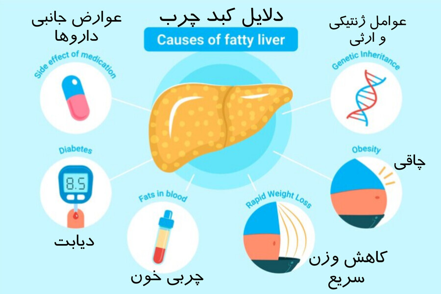 دلایل کبد چرب